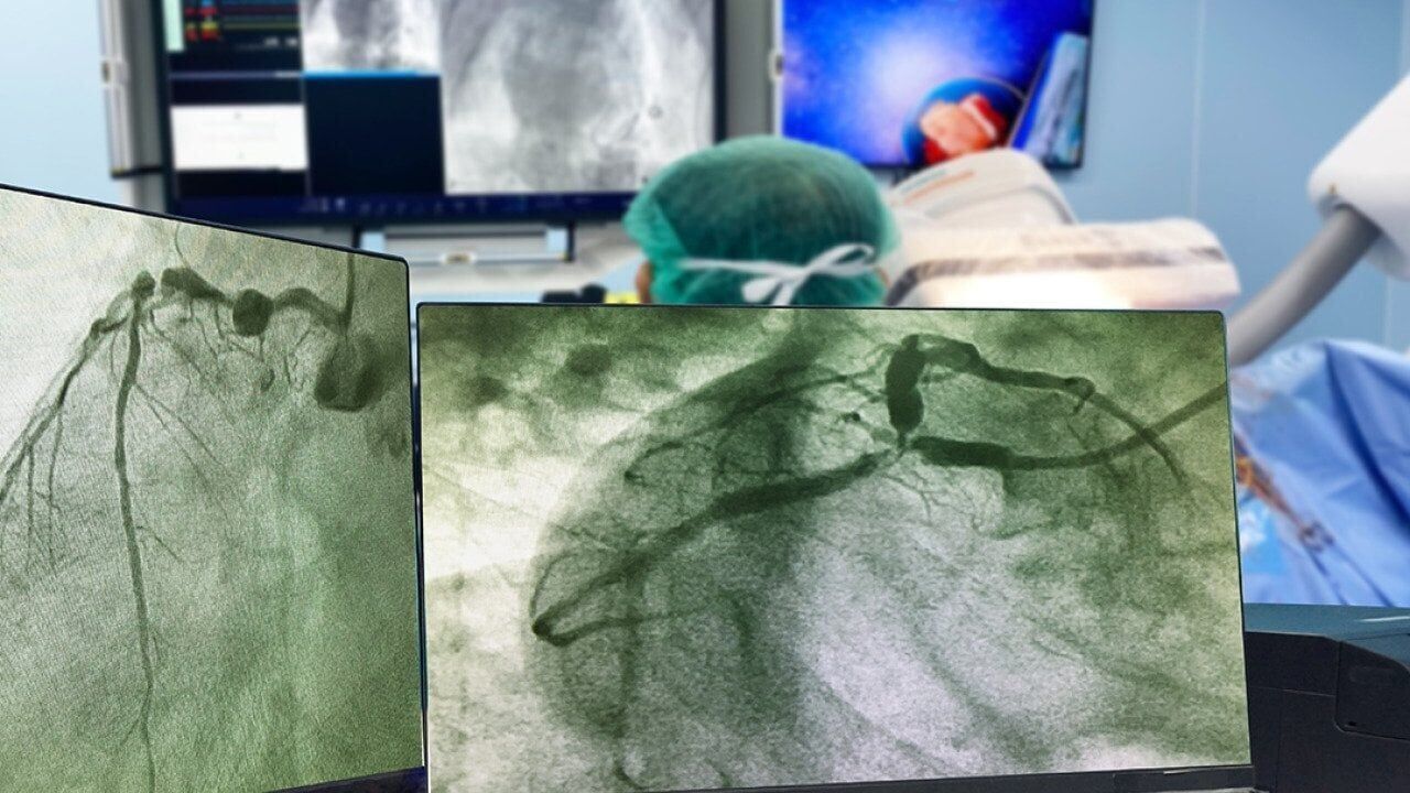 Do you need a heart checkup?